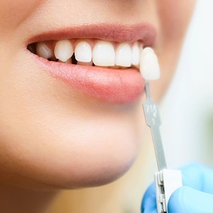 歯牙移植について